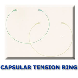 Capsular Tension Ring